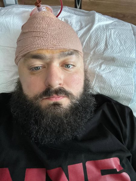 Олександр Венедчук операція Олександр Венедчук, гуморист